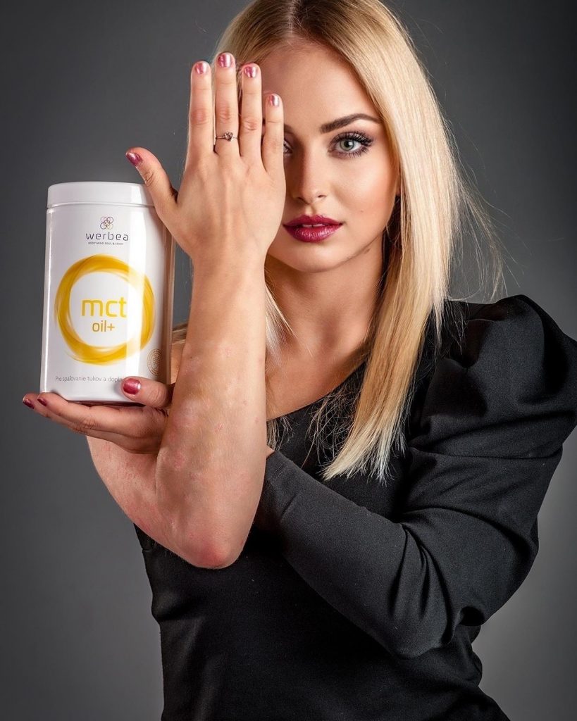 Doplňte energii a potřebné vitamíny s produkty Werbea.